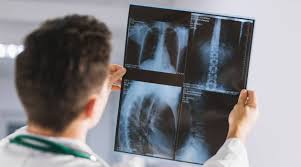 ¿Cuanto gana un radiologo en España?